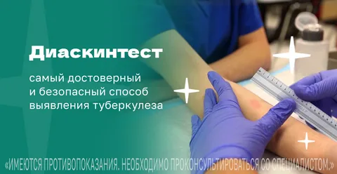 Расписание постановки пробы 